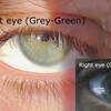 Eyecolorpictures